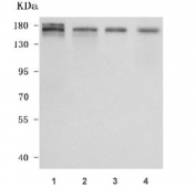 Western blot testing of human 1) HEL, 2) RT-4, 3) Caco-2 and 4) HaCaT cell lysate with NFRKB antibody. Predicted molecular weight ~139 kDa, commonly observed at ~175 kDa and can be observed at ~220 kDa.