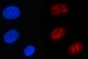 Immunofluorescent staining of FFPE human A549 cells with NFRKB antibody (red) and DAPI nuclear stain (blue). HIER: steam section in pH6 citrate buffer for 20 min.