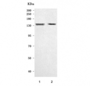 Western blot testing of human 1) HeLa and 2) HepG2 cell lysate with Niemann Pick C1 antibody. Expected molecular weight: 140-190 kDa depending on glycosylation level.