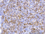 IHC staining of FFPE human tonsil tissue with PFKFB1 antibody. HIER: boil tissue sections in pH8 EDTA for 20 min and allow to cool before testing.