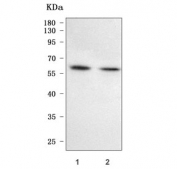 Western blot testing of human 1) HCCT and 2) HCCP cell lysate with PFKFB1 antibody. Predicted molecular weight ~55 kDa and ~47 kDa (two isoforms).