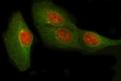 Immunofluorescent staining of FFPE human U-2 OS cells with POLR2D antibody (red) and Beta Tubulin mAb (green). HIER: steam section in pH6 citrate buffer for 20 min.