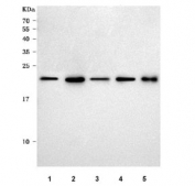 Western blot testing of 1) human A431, 2) human HeLa, 3) human HepG2, 4) human MCF7 and 5) rat liver tissue lysate with RPB5 antibody. Predicted molecular weight ~24 kDa.