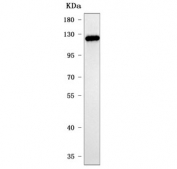 Western blot testing of human A431 cell lysate with PPP2R3A antibody. Predicted molecular weight ~130 kDa and ~72 kDa as well as possibly ~48 kDa (multiple isoforms).