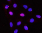 Immunofluorescent staining of FFPE human U-2 OS cells with PPP2R3A antibody (red) and DAPI nuclear stain (blue). HIER: steam section in pH6 citrate buffer for 20 min.