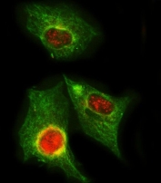 Immunofluorescent staining of FFPE human A549 cells with GNB1 antibody (red) and Beta Tubulin mAb (green). HIER: steam section in pH6 citrate buffer for 20 min.