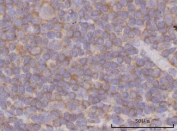 IHC staining of FFPE human tonsil tissue with PPP3CB antibody. HIER: boil tissue sections in pH8 EDTA for 20 min and allow to cool before testing.