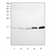 Western blot testing of 1) human K562, 2) human HeLa, 3) human SH-SY5Y, 4) rat brain and 5) mouse brain tissue lysate with Calcineurin B antibody. Predicted molecular weight ~19 kDa.