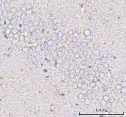 IHC staining of FFPE rat brain tissue with Calcineurin B antibody. HIER: boil tissue sections in pH8 EDTA for 20 min and allow to cool before testing.