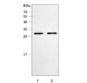 Western blot testing of 1) rat brain and 2) mouse brain tissue lysate with Prolactin antibody. Predicted molecular weight ~26 kDa.