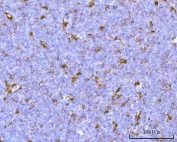 IHC staining of FFPE human tonsil tissue with Prosaposin antibody. HIER: boil tissue sections in pH8 EDTA for 20 min and allow to cool before testing.