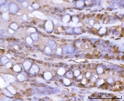 IHC staining of FFPE rat colon tissue with Proteasome 20S alpha 1 antibody. HIER: boil tissue sections in pH8 EDTA for 20 min and allow to cool before testing.