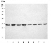 Western blot testing of 1) human MCF7, 2) human PC-3, 3) human HepG2, 4) human Jurkat, 5) rat brain, 6) rat liver, 7) mouse brain and 8) mouse liver tissue lysate with Proteasome 20S alpha 1 antibody. Predicted molecular weight ~30 kDa.