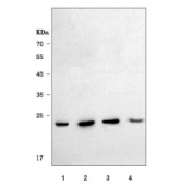 Western blot testing of human 1) 293T, 2) HeLa, 3) Jurkat and 4) human placenta tissue lysate with PSMB2 antibody. Predicted molecular weight ~23 kDa.