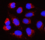 Immunofluorescent staining of FFPE human U-2 OS cells with PSMB2 antibody (red) and DAPI nuclear stain (blue). HIER: steam section in pH6 citrate buffer for 20 min.