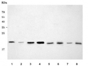 Western blot testing of 1) human Raji, 2) human HepG2, 3) human Jurkat, 4) human ThP-1, 5) rat spleen, 6) rat thymus, 7) mouse spleen and 8) mouse thymus tissue lysate with Proteasome subunit beta type 9 antibody. Predicted molecular weight ~23 kDa.