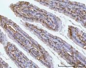 IHC staining of FFPE mouse colon tissue with PSMC4 antibody. HIER: boil tissue sections in pH8 EDTA for 20 min and allow to cool before testing.