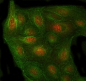 Immunofluorescent staining of FFPE human U-2 OS cells with PSMC4 antibody (red) and Beta Tubulin mAb (green). HIER: steam section in pH6 citrate buffer for 20 min.
