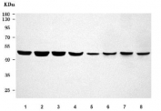 Western blot testing of 1) human HepG2, 2) human U-251, 3) human U-251, 4) human A549, 5) rat liver, 6) rat brain, 7) mouse liver and 8) mouse brain tissue lysate with PSMC4 antibody. Predicted molecular weight: 44-47 kDa (multiple isoforms).