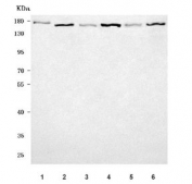 Western blot testing of 1) human HeLa, 2) human 293T, 3) rat brain, 4) rat C6, 5) mouse brain and 6) mouse NIH 3T3 cell lysate with ROCK1 antibody. Predicted molecular weight ~158 kDa.