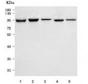Western blot testing of 1) human PC-3, 2) monkey COS-7, 3) human Jurkat, 4) human SK-O-V3 and 5) rat heart tissue lysate with PSMD2 antibody. Predicted molecular weight: 82-100 kDa (multiple isoforms).