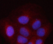 Immunofluorescent staining of FFPE human U-2 OS cells with PSMD2 antibody (red) and DAPI nuclear stain (blue). HIER: steam section in pH6 citrate buffer for 20 min.