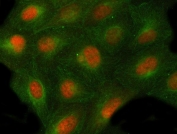 Immunofluorescent staining of FFPE human U-2 OS cells with PSMD4 antibody (red) and Beta Tubulin mAb (green). HIER: steam section in pH6 citrate buffer for 20 min.