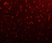 Immunofluorescent staining of FFPE rat brain tissue with PSMD4 antibody (red). HIER: steam section in pH8 EDTA buffer for 20 min.