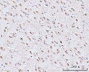 IHC staining of FFPE rat brain tissue with PSMD4 antibody. HIER: boil tissue sections in pH8 EDTA for 20 min and allow to cool before testing.