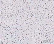 IHC staining of FFPE mouse brain tissue with PSMD4 antibody. HIER: boil tissue sections in pH8 EDTA for 20 min and allow to cool before testing.