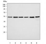 Western blot testing of 1) human Jurkat, 2) human K562, 3) human HeLa, 4) human Raji, 5) rat C6 and 6) mouse RAW264.7 cell lysate with PSMD4 antibody. Predicted molecular weight ~41 kDa, routinely observed at ~50 kDa.