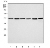 Western blot testing of 1) human Jurkat, 2) human K562, 3) human HeLa, 4) human Raji, 5) rat C6 and 6) mouse RAW264.7 cell lysate with PSMD4 antibody. Predicted molecular weight ~41 kDa, routinely observed at ~50 kDa.