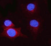 Immunofluorescent staining of FFPE human A549 cells with PSME1 antibody (red) and DAPI nuclear stain (blue). HIER: steam section in pH6 citrate buffer for 20 min.