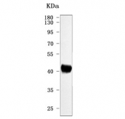 Western blot testing of human HT-1080 cell lysate with Twinfilin 1 antibody. Predicted molecular weight ~40 kDa.