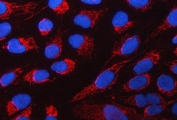 Immunofluorescent staining of FFPE human U-2 OS cells with PYCR1 antibody (red) and DAPI nuclear stain (blue). HIER: steam section in pH6 citrate buffer for 20 min.