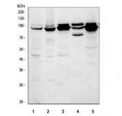 Western blot testing of 1) human HaCaT, 2) human PC-3, 3) rat liver, 4) rat lung and 5) mouse liver tissue lysate with PYGL antibody. Predicted molecular weight ~97 kDa.