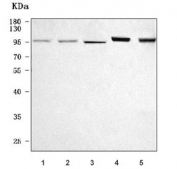 Western blot testing of 1) human HeLa, 2) human HepG2, 3) human 293T, 4) rat liver and 5) mouse liver tissue lysate with PYGL antibody. Predicted molecular weight ~97 kDa.