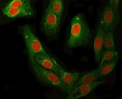 Immunofluorescent staining of FFPE human U-2 OS cells with RFC4 antibody (red) and Beta Tubulin mAb (green). HIER: steam section in pH6 citrate buffer for 20 min.