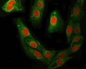 Immunofluorescent staining of FFPE human U-2 OS cells with RFC4 antibody (red) and Beta Tubulin mAb (green). HIER: steam section in pH6 citrate buffer for 20 min.