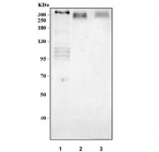 Western blot testing of 1) human HeLa, 2) rat heart and 3) mouse heart tissue lysate with TP53BP1 antibody. Predicted molecular weight: ~214 kDa but may be observed at up to ~450 kDa.