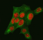 Immunofluorescent staining of FFPE human U-2 OS cells with TP53BP1 antibody (red) and Beta Tubulin mAb (green). HIER: steam section in pH6 citrate buffer for 20 min.