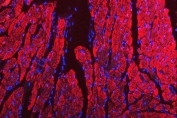 Immunofluorescent staining of FFPE rat heart tissue with VDAC1 antibody (red) and DAPI nuclear stain (blue). HIER: steam section in pH8 EDTA buffer for 20 min.