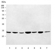 Western blot testing of 1) human HeLa, 2) human A431, 3) human 293T, 4) rat heart, 5) rat liver, 6) mouse heart and 7) mouse liver tissue lysate with VDAC1 antibody. Predicted molecular weight 30~35 kDa.