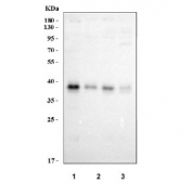 Western blot testing of human 1) 293T, 2) HeLa, 3) MCF7 and 4) A549 cell lysate with XPA antibody. Predicted molecular weight ~31 kDa, commonly observed at 31-40 kDa.