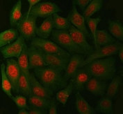 Immunofluorescent staining of FFPE human HeLa cells with XPA antibody (red) and Beta Tubulin mAb (green). HIER: steam section in pH6 citrate buffer for 20 min.