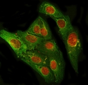 Immunofluorescent staining of FFPE human U-2 OS cells with PRDM2 antibody (red) and Beta Tubulin mAb (green). HIER: steam section in pH6 citrate buffer for 20 min.