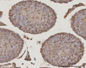 IHC staining of FFPE mouse testis tissue with PRDM2 antibody. HIER: boil tissue sections in pH8 EDTA for 20 min and allow to cool before testing.