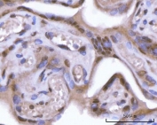 IHC staining of FFPE human placenta tissue with SF3a66 antibody. HIER: boil tissue sections in pH8 EDTA for 20 min and allow to cool before testing.