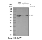 Immunoprecipitation of SF3a66 protein from 500ug of human SH-SY5Y whole cell lysate with 2ug of SF3a66 antibody.