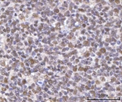 IHC staining of FFPE human tonsil tissue with SF3a66 antibody. HIER: boil tissue sections in pH8 EDTA for 20 min and allow to cool before testing.